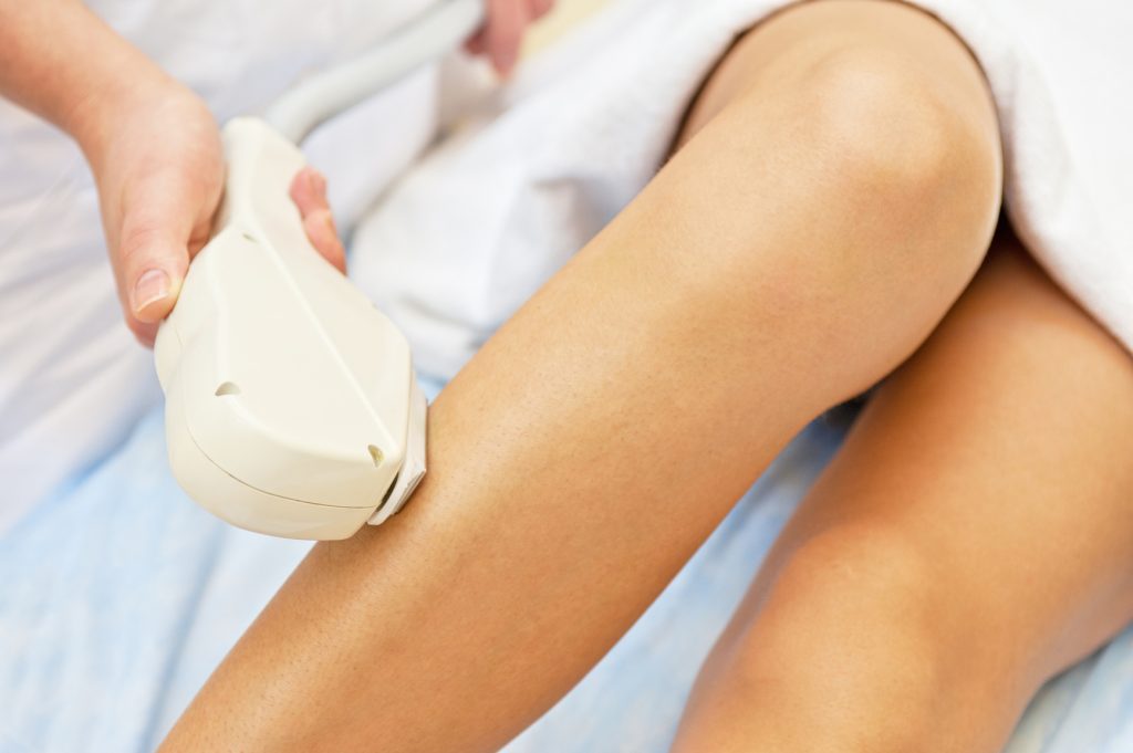 Laser hair removal in Plano TX