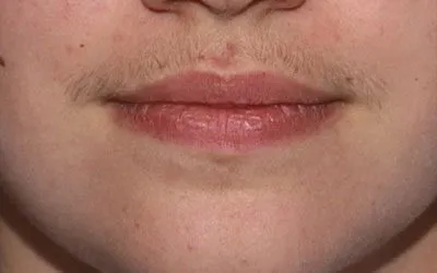 Layer-1-3-400×250-1