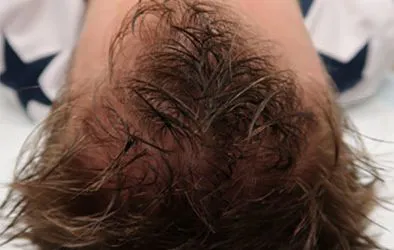 Layer-1-5-394×250-1