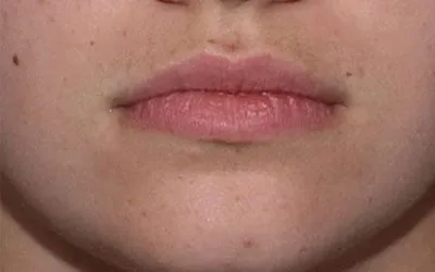 Layer-2-2-400×250-1