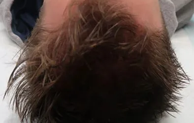 Layer-2-4-394×250-1