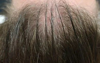 Layer-3-4-394×250-1