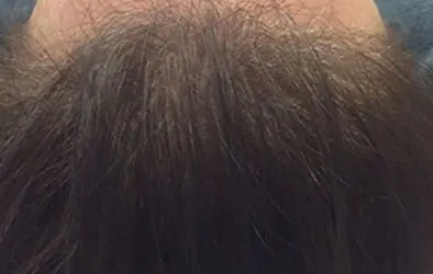 Layer-4-4-394×250-1